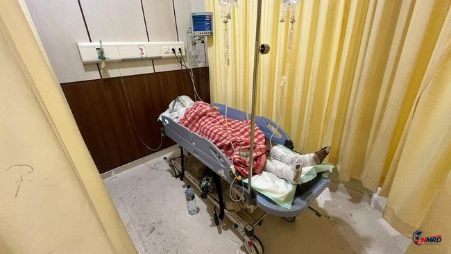 Ledakan Hebat di SPPG Mojokerto Puri Medali, Atap Runtuh dan Picu Kebakaran, 5 Orang Terluka